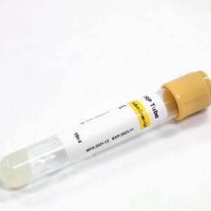 Siny Medical Disposable Vacuum Blood Sample Vials PRP Tube