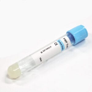 Siny Platelet Rich Plasma PRP Tube with Sodium Citrate & Gel