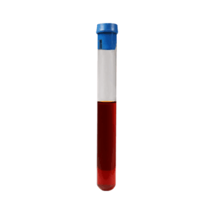 Siny Medical Iron - Oxidizing Bacteria IOB Test Tube for Water Quality Detection
