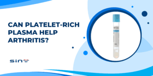 Can Platelet-Rich Plasma Help Arthritis?