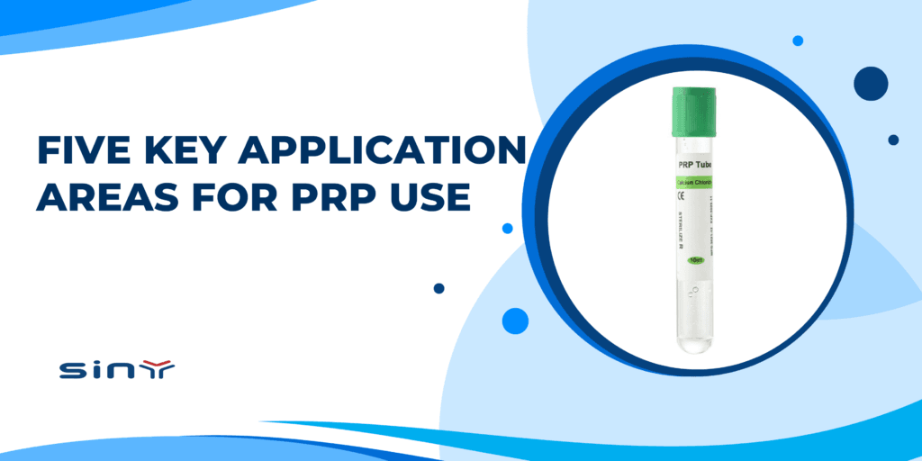 Five Key Application Areas for PRP Use