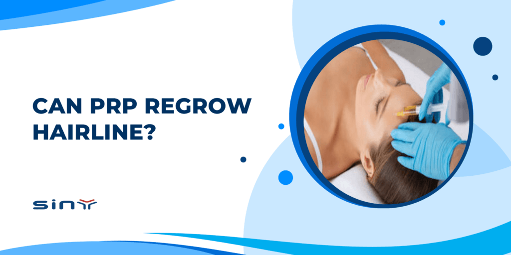 Can PRP Regrow Hairline?