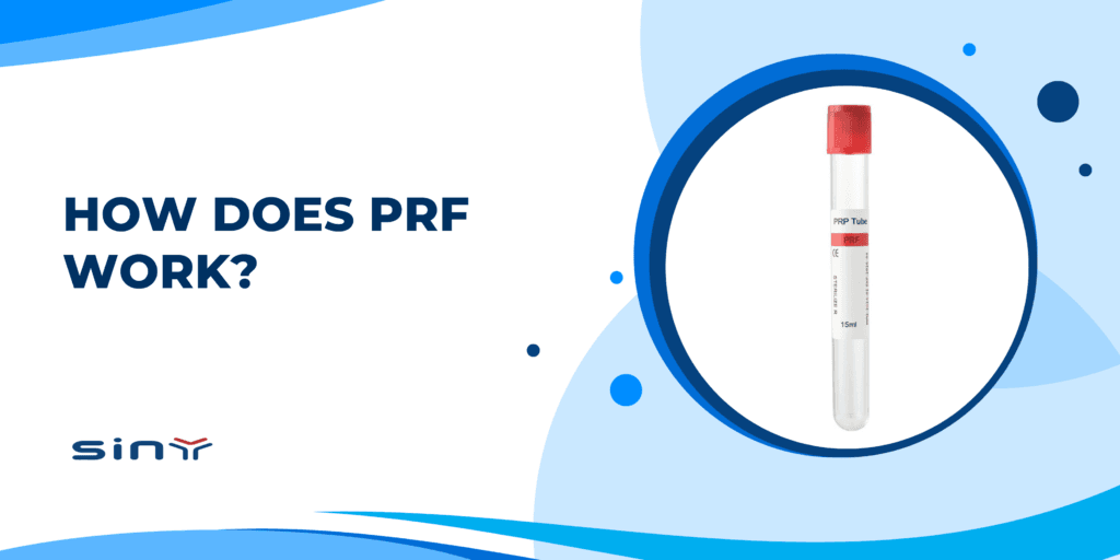 How Does PRF Work?
