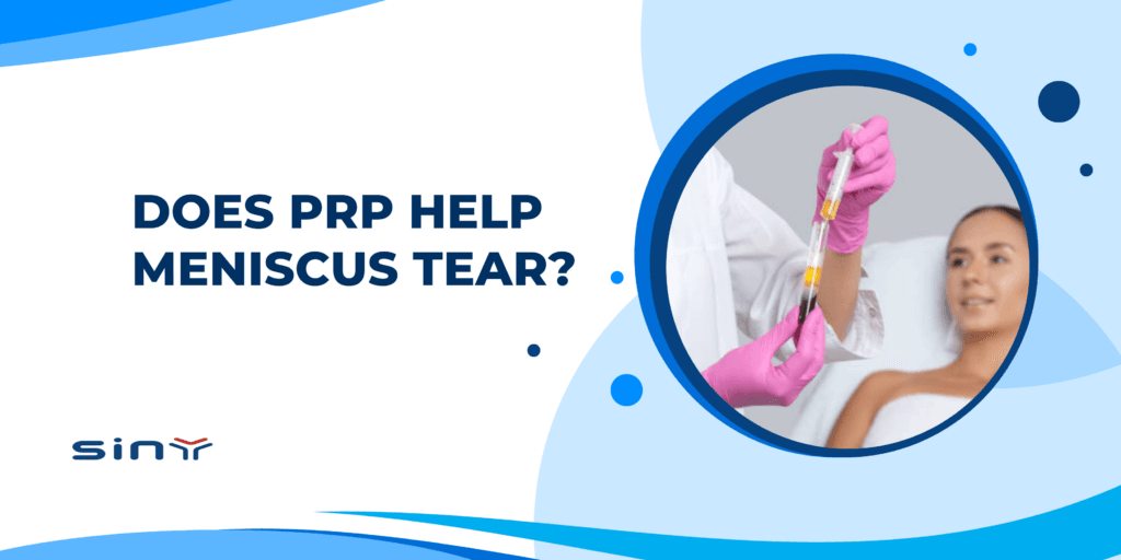 Does PRP Help Meniscus Tear?