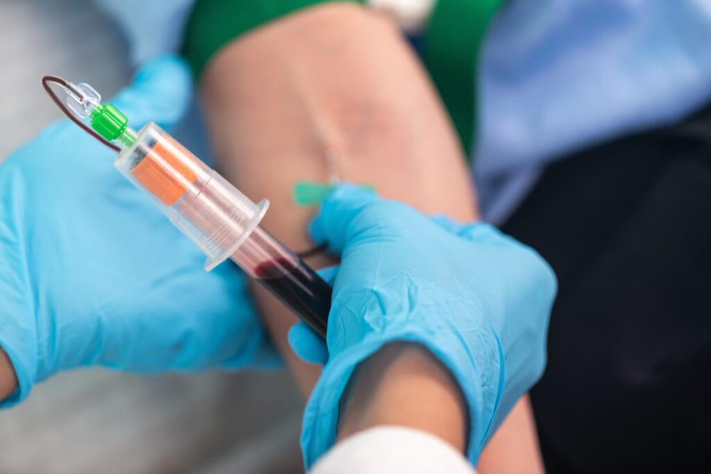 Nurse draws blood for lab tests, performing phlebotomy.