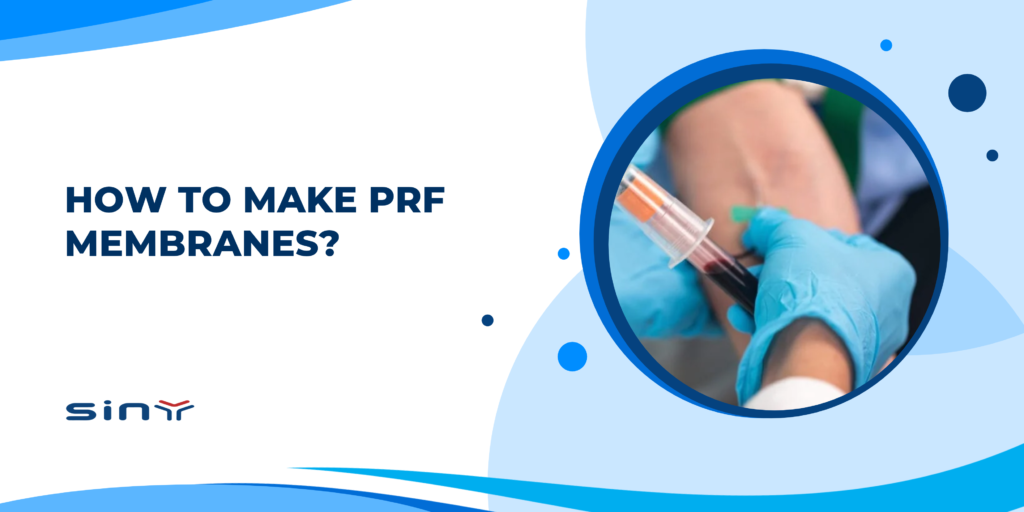 How to Make PRF Membranes